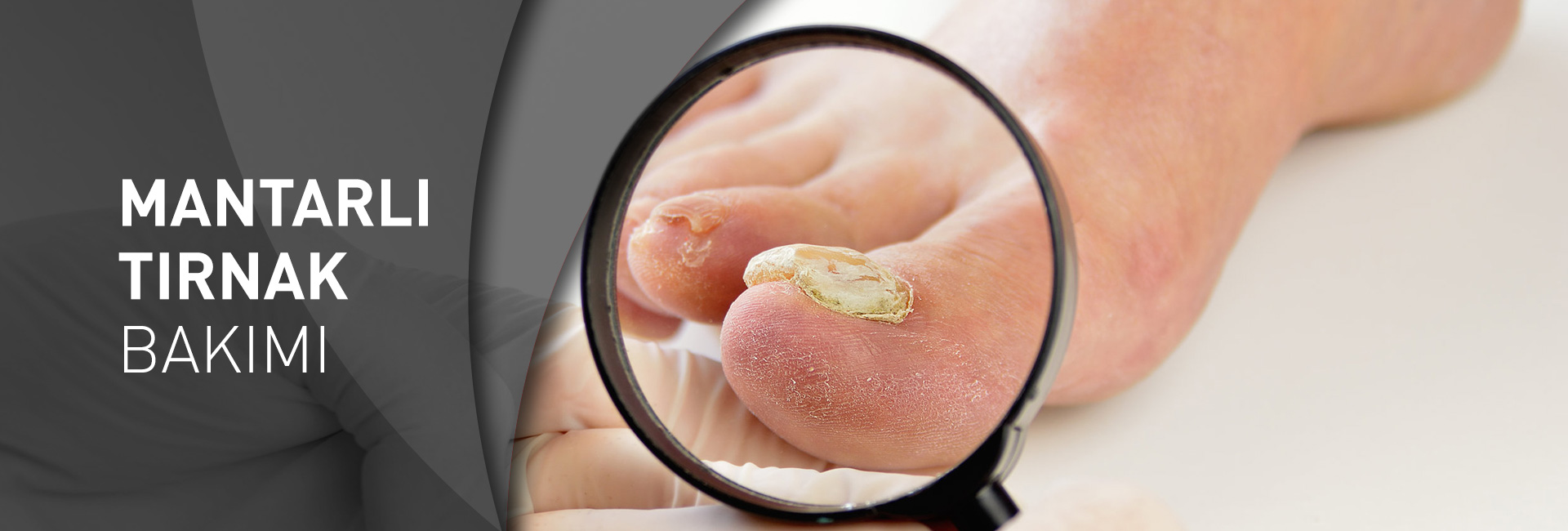 Norveç Ayak Sağlığı