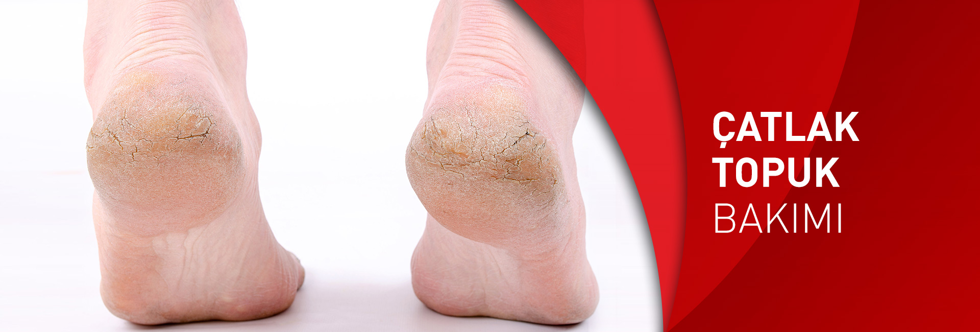 Norveç Ayak Sağlığı