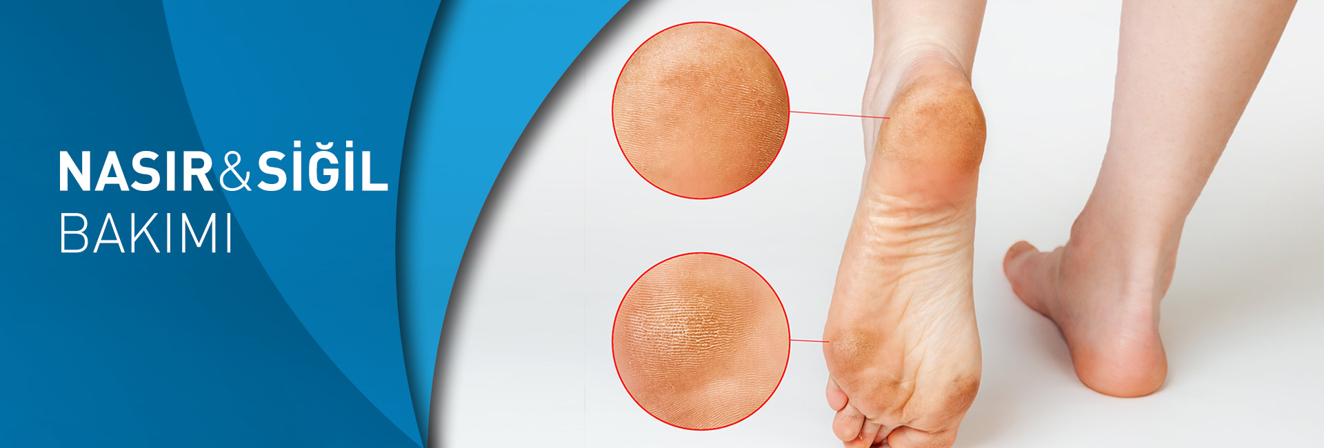 Norveç Ayak Sağlığı